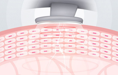按摩儀選擇有哪些注意事項?國產的品牌靠譜嗎?